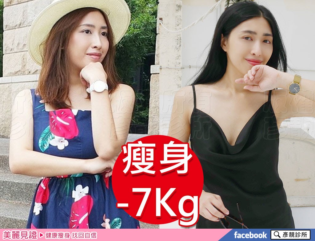 部落客成功瘦身前後照片比對,彥靚診所減重門診效果好推薦