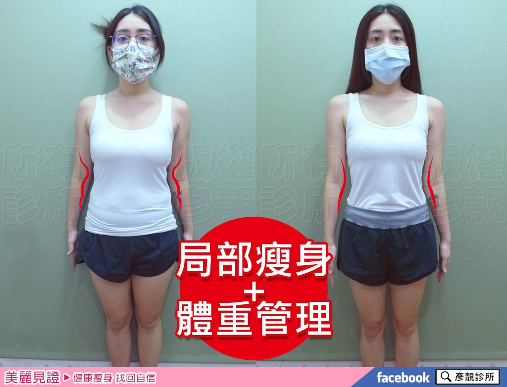 瘦還要更瘦,部落客成功剷除肥胖推薦藥物+減肥筆