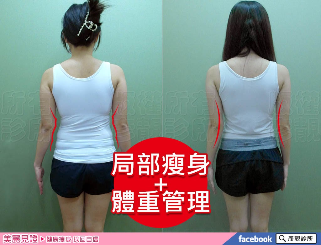 部落客成功減重分享,產後肥胖不是理由,夏季瘦身方法推薦