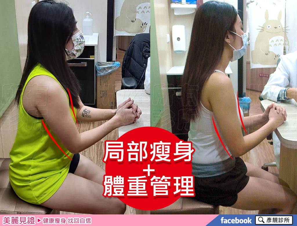 瘦手臂效果好,建議全身瘦身,夏季減肥方法藥物+減肥筆