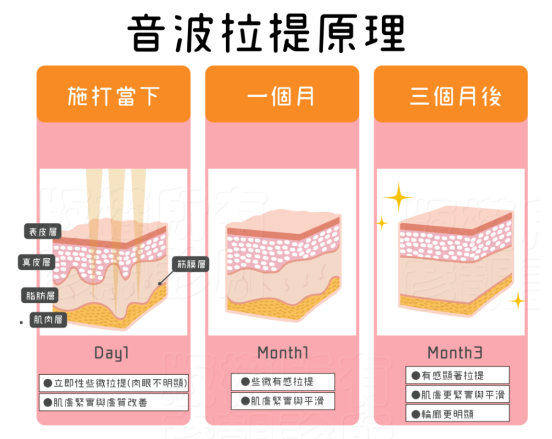 音波拉提原理