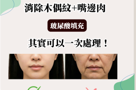 木偶紋嘴邊肉一併消除精選3