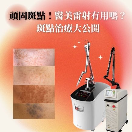 治療斑點雷射怎麼選?斑點種類形成原因,傳統雷射和皮秒雷射治療差在哪? 46 彥靚診所雷射去斑