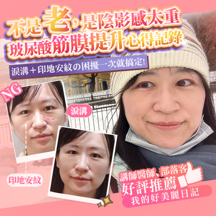 醫美分享 擺脫淚溝、印地安紋困擾同時拉提緊緻 彥靚診所 玻尿酸無痕筋膜提升推薦 18 玻尿酸 淚溝 眼袋 肉毒 除皺 皺紋 抬頭紋 皺眉 木偶紋 法令紋 印地安紋 黑眼圈 熊貓針 墊下巴 下顎線 筋膜拉提 下垂 拉提 效果 彥靚診所 醫美 門診 醫生 桃園 台北 新竹 Dcard ppt 115011501