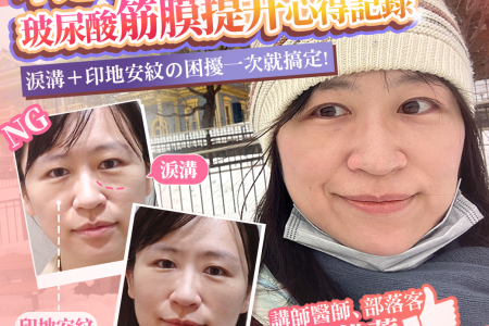 玻尿酸 淚溝 眼袋 肉毒 除皺 皺紋 抬頭紋 皺眉 木偶紋 法令紋 印地安紋 黑眼圈 熊貓針 墊下巴 下顎線 筋膜拉提 下垂 拉提 效果 彥靚診所 醫美 門診 醫生 桃園 台北 新竹 Dcard ppt 115011501