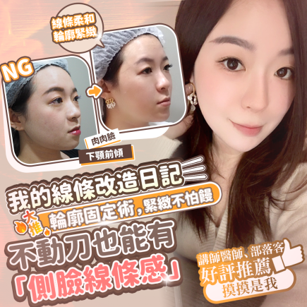 醫美|玻尿酸可以改善下顎前傾?打造精緻輪廓線,玻尿酸會位移、饅化?用8年親身分享|彥靚醫美診所 2 下巴 不動刀矯正 顎凸 輪廓固定 玻尿酸 彥靚 診所 大分子 推薦 外輪廓提升 價格費用 台北 桃園 新竹 戽斗 評價 黃政達 醫師 位移 變形 副作用 併發症 後遺症 心得 分享 饅化 115020701