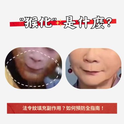 猴化是甚麼？