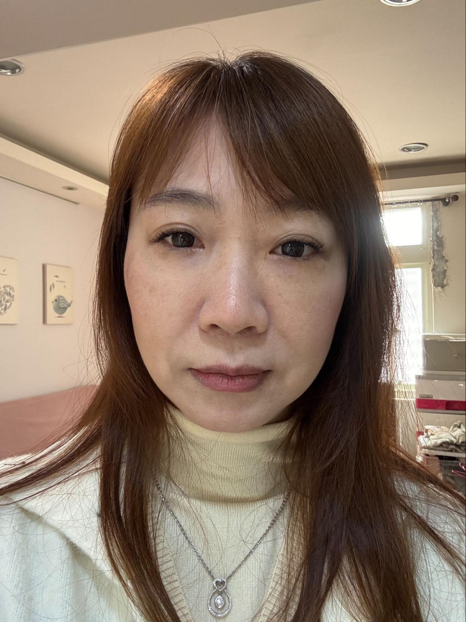 法令紋真的藏不住年紀?淚溝失敗竟然有得救?告別無盡的修圖深淵|神奇的 4D無痕筋膜提升 2 彥靚診所 4D無痕筋膜提升 黃政達醫師 拉提 緊緻 淚溝重修 眼袋 法令紋 玻尿酸 填補 幼態臉 複合式微整 鬆弛 下垂 嘴邊肉 雙下巴 輪廓線 下顎線 淚溝硬塊 分享 推薦 桃園 台北 新竹 1150060103