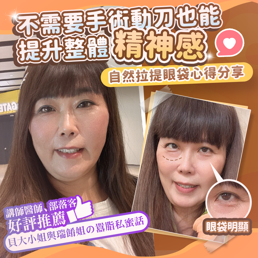 淚溝眼袋療程推薦 彥靚診所 黃政達醫師 不動刀就能告別疲憊感,自然感才是王道! 1 玻尿酸 淚溝 眼袋 肉毒 除皺 皺紋 抬頭紋 皺眉 木偶紋 法令紋 黑眼圈 熊貓針 墊下巴 下顎線 筋膜拉提 下垂 拉提 效果 費用 價格 彥靚診所 醫美 門診 醫生 桃園 台北 新竹 Dcard ppt 115062201