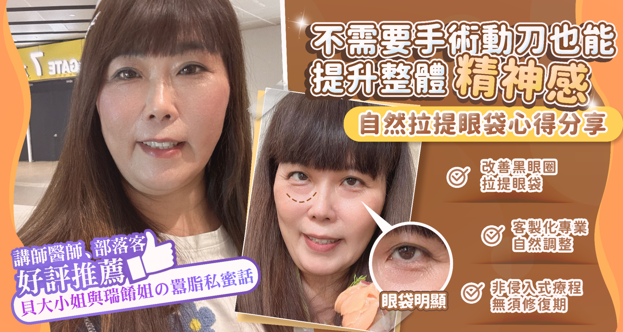 淚溝眼袋療程推薦 彥靚診所 黃政達醫師 不動刀就能告別疲憊感,自然感才是王道! 1 玻尿酸 淚溝 眼袋 肉毒 除皺 皺紋 抬頭紋 皺眉 木偶紋 法令紋 黑眼圈 熊貓針 墊下巴 下顎線 筋膜拉提 下垂 拉提 效果 費用 價格 彥靚診所 醫美 門診 醫生 桃園 台北 新竹 Dcard ppt 115062202