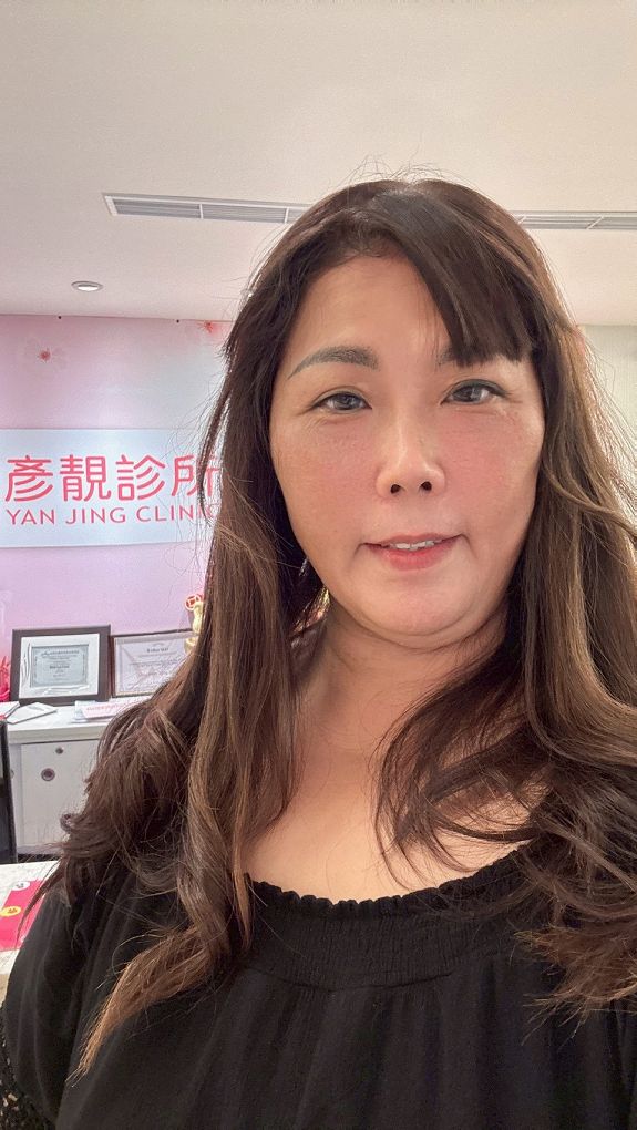淚溝眼袋療程推薦 彥靚診所 黃政達醫師 不動刀就能告別疲憊感,自然感才是王道! 8 玻尿酸 淚溝 眼袋 肉毒 除皺 皺紋 抬頭紋 皺眉 木偶紋 法令紋 黑眼圈 熊貓針 墊下巴 下顎線 筋膜拉提 下垂 拉提 效果 費用 價格 彥靚診所 醫美 門診 醫生 桃園 台北 新竹 Dcard ppt 115062215