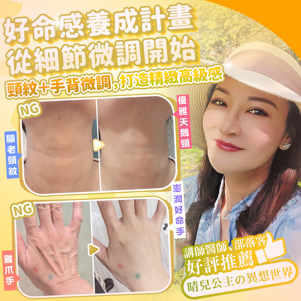 告別顯老頸紋與雞爪手!大分子玻尿酸打造高級天鵝頸與貴婦澎潤感 1 雞爪手 不動刀改善 脖紋 頸部拉提 玻尿酸 彥靚 診所 膠原蛋白 推薦 撫紋填補 價格費用 台北 桃園 新竹 頸紋 評價 黃政達 醫師 結節 凹凸不平 副作用 併發症 後遺症 心得 分享 硬塊 115061901
