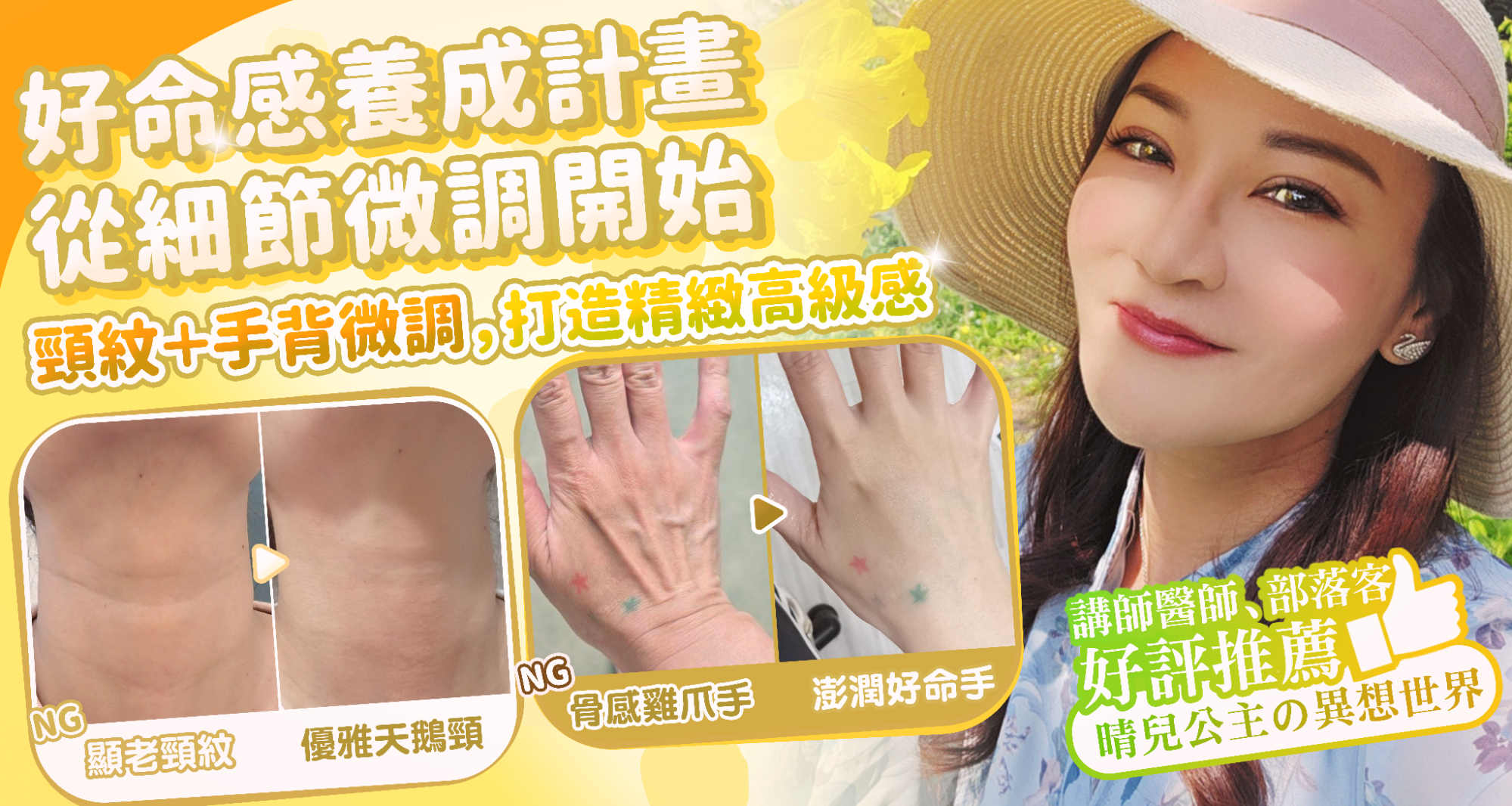 告別顯老頸紋與雞爪手!大分子玻尿酸打造高級天鵝頸與貴婦澎潤感 1 雞爪手 不動刀改善 脖紋 頸部拉提 玻尿酸 彥靚 診所 膠原蛋白 推薦 撫紋填補 價格費用 台北 桃園 新竹 頸紋 評價 黃政達 醫師 結節 凹凸不平 副作用 併發症 後遺症 心得 分享 硬塊 115061902