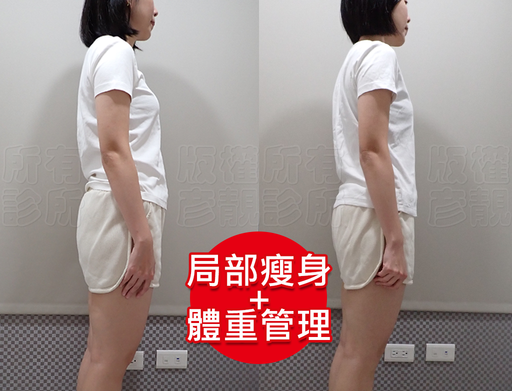 從70kg到輕盈體態!產後瘦身之路不再艱辛,一起回到原本的自己! 20 dieting experience sharing