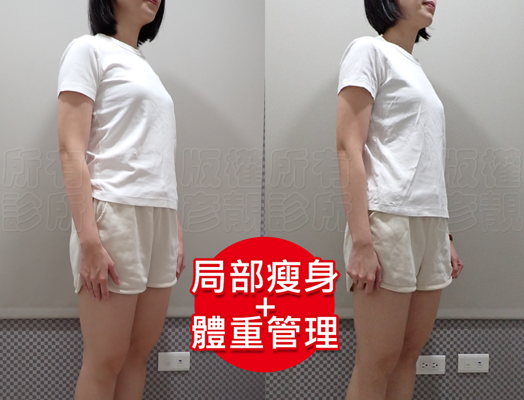 從70kg到輕盈體態!產後瘦身之路不再艱辛,一起回到原本的自己! 17 edema slimming method