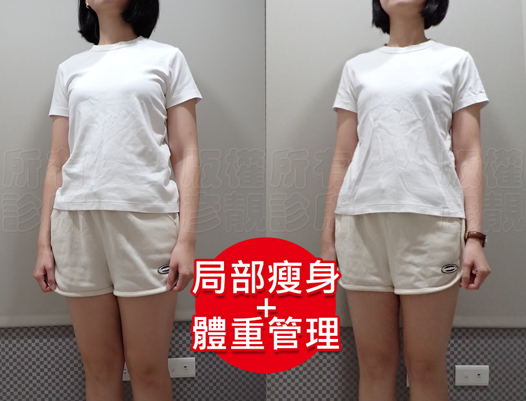 從70kg到輕盈體態!產後瘦身之路不再艱辛,一起回到原本的自己! 21 obesity outpatient doctor