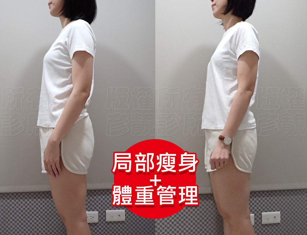 從70kg到輕盈體態!產後瘦身之路不再艱辛,一起回到原本的自己! 24 postpartum obesity clinic