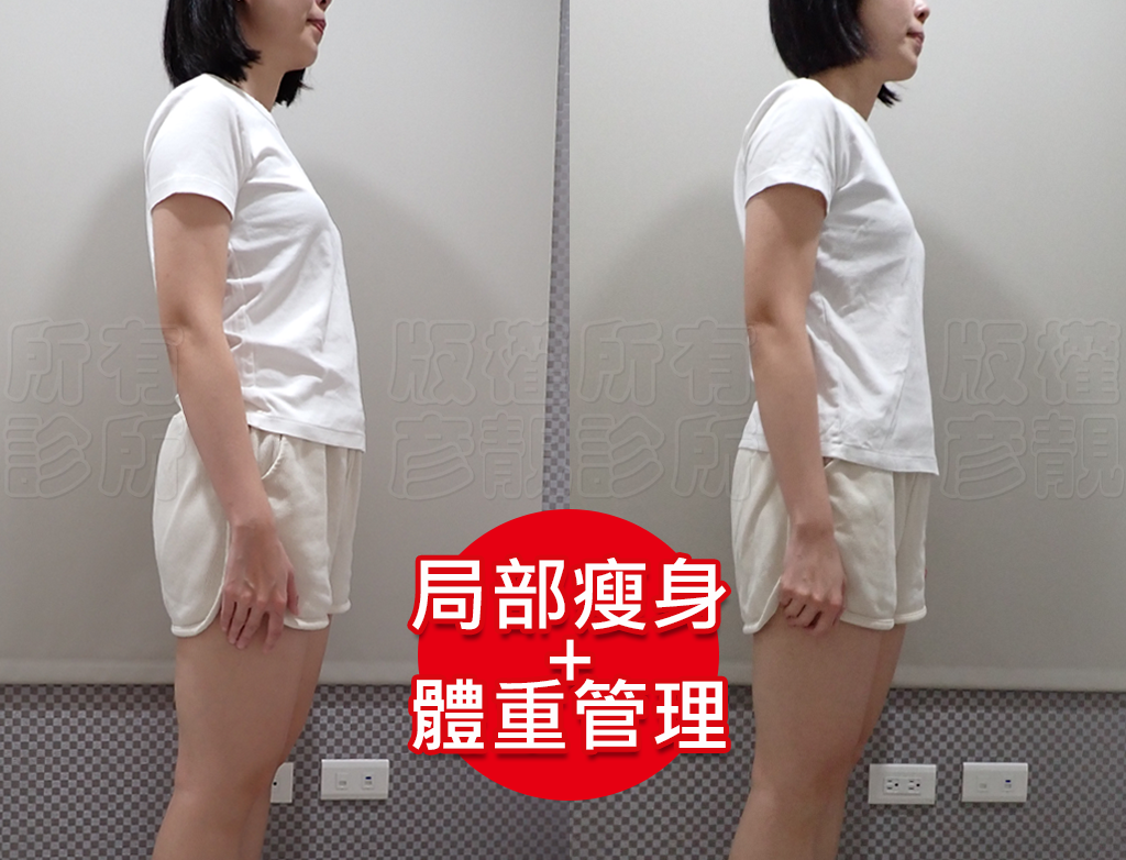 從70kg到輕盈體態!產後瘦身之路不再艱辛,一起回到原本的自己! 19 tcm slimming improvement