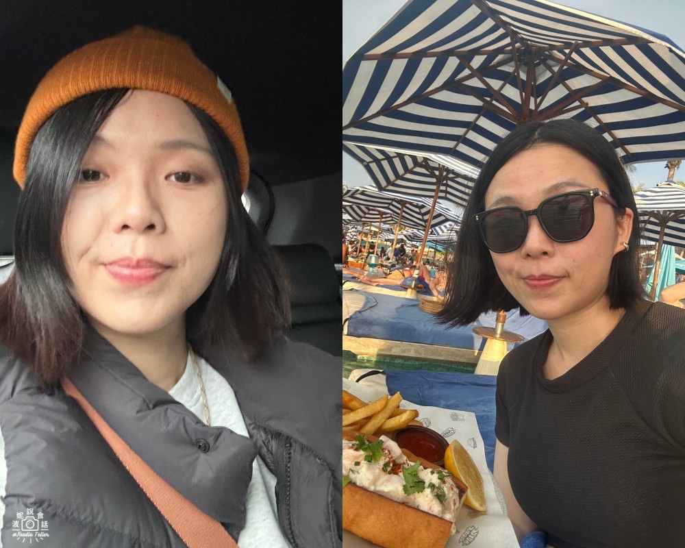 從70kg到輕盈體態!產後瘦身之路不再艱辛,一起回到原本的自己! 4 tcm thread embedding method
