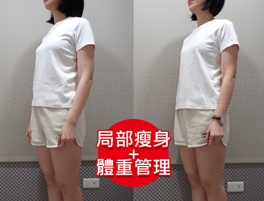 從70kg到輕盈體態!產後瘦身之路不再艱辛,一起回到原本的自己! 23 thread embedding experience sharing