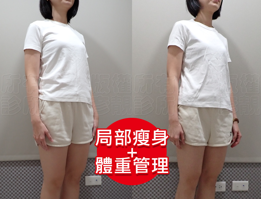 從70kg到輕盈體態!產後瘦身之路不再艱辛,一起回到原本的自己! 18 thread embedding price cost