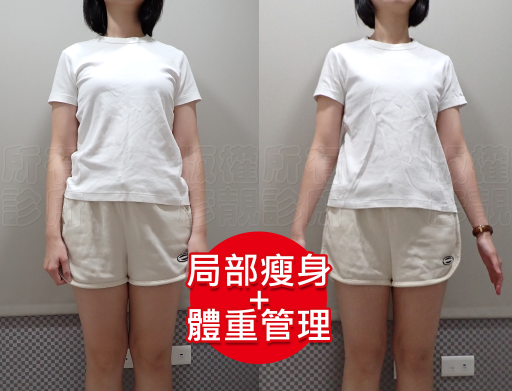 從70kg到輕盈體態!產後瘦身之路不再艱辛,一起回到原本的自己! 16 weight loss price cost