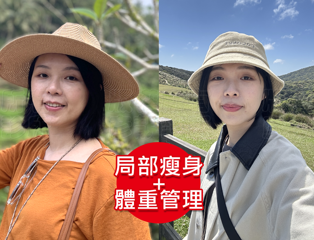從70kg到輕盈體態!產後瘦身之路不再艱辛,一起回到原本的自己! 25 yan jing clinic reviews