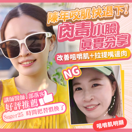 終於去處理我的咀嚼肌了!肉毒瘦小臉給我自信好上相 真實心得分享文 1 yanjing botox clinic
