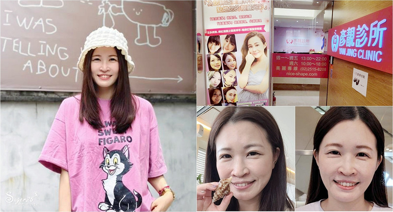 終於去處理我的咀嚼肌了!肉毒瘦小臉給我自信好上相 真實心得分享文 2 yanjing v line treatment