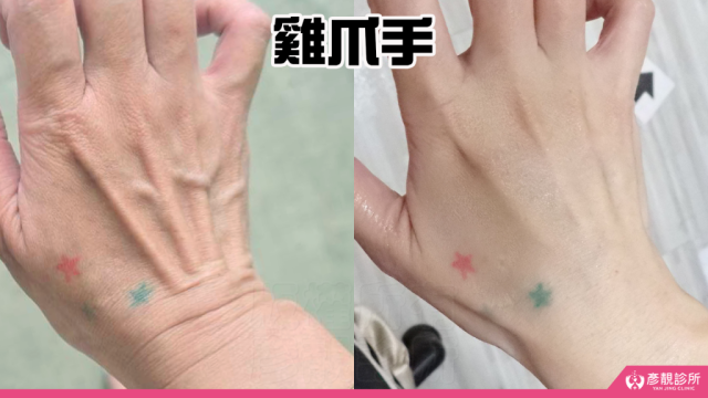雞爪手 2 1024x576