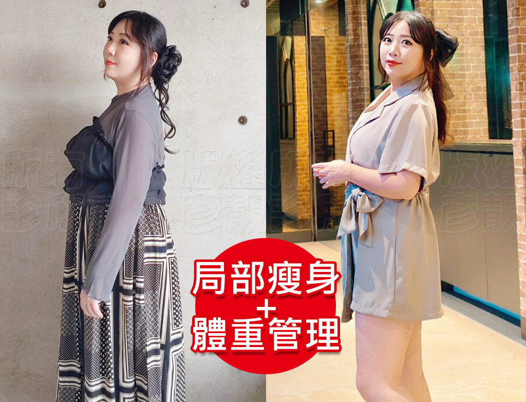 減重門診推薦|彥靚診所減重12公斤實錄:飲食控制、健身、旅行與外食經驗分享 49 fat loss medicine plan