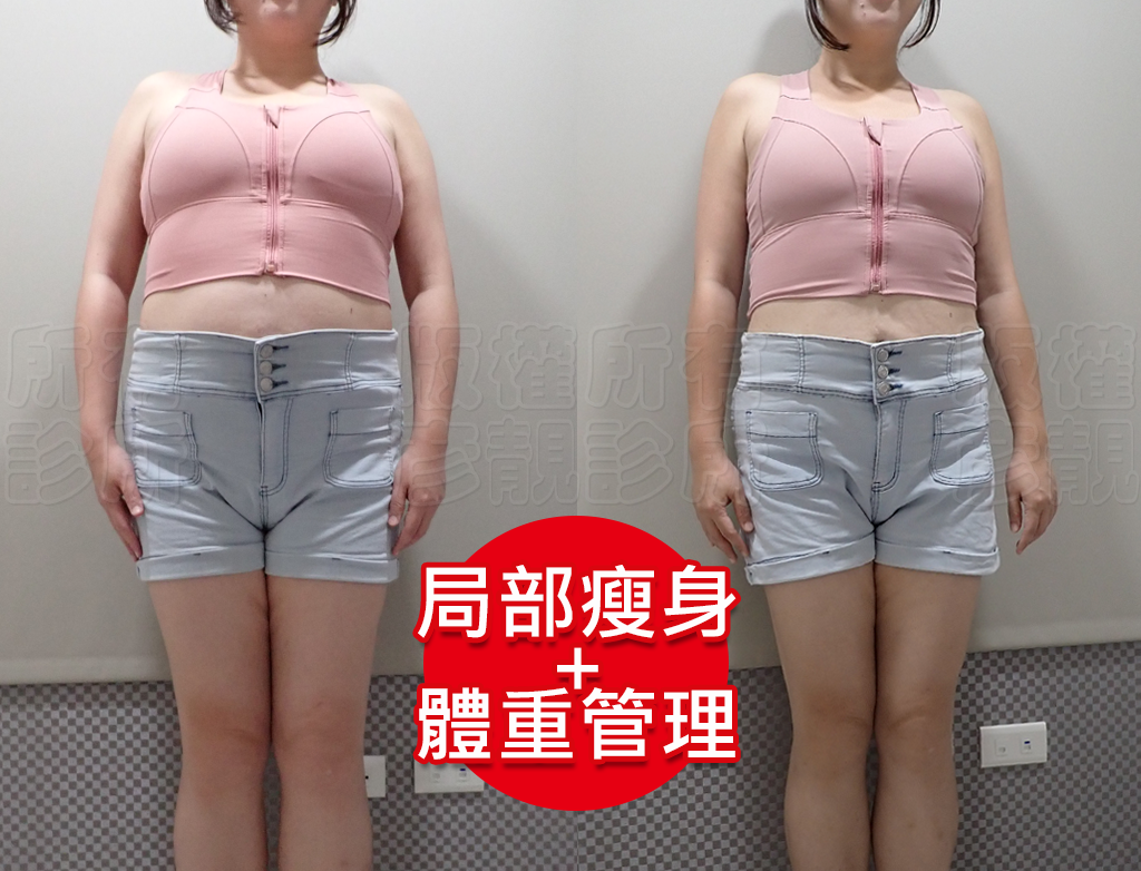 減重門診推薦|彥靚診所減重12公斤實錄:飲食控制、健身、旅行與外食經驗分享 36 image20