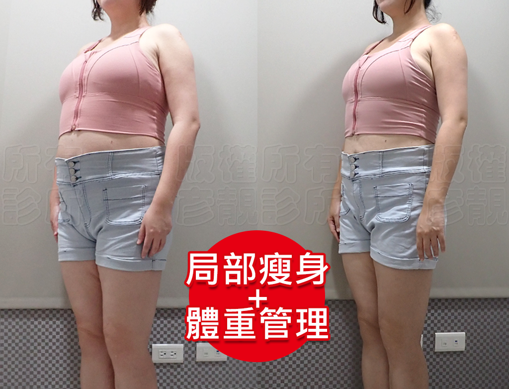 減重門診推薦|彥靚診所減重12公斤實錄:飲食控制、健身、旅行與外食經驗分享 41 image22