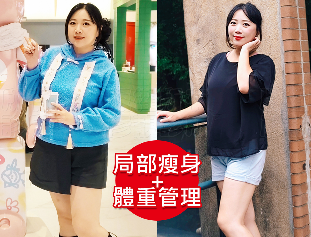 減重門診推薦|彥靚診所減重12公斤實錄:飲食控制、健身、旅行與外食經驗分享 45 lazy weight loss method