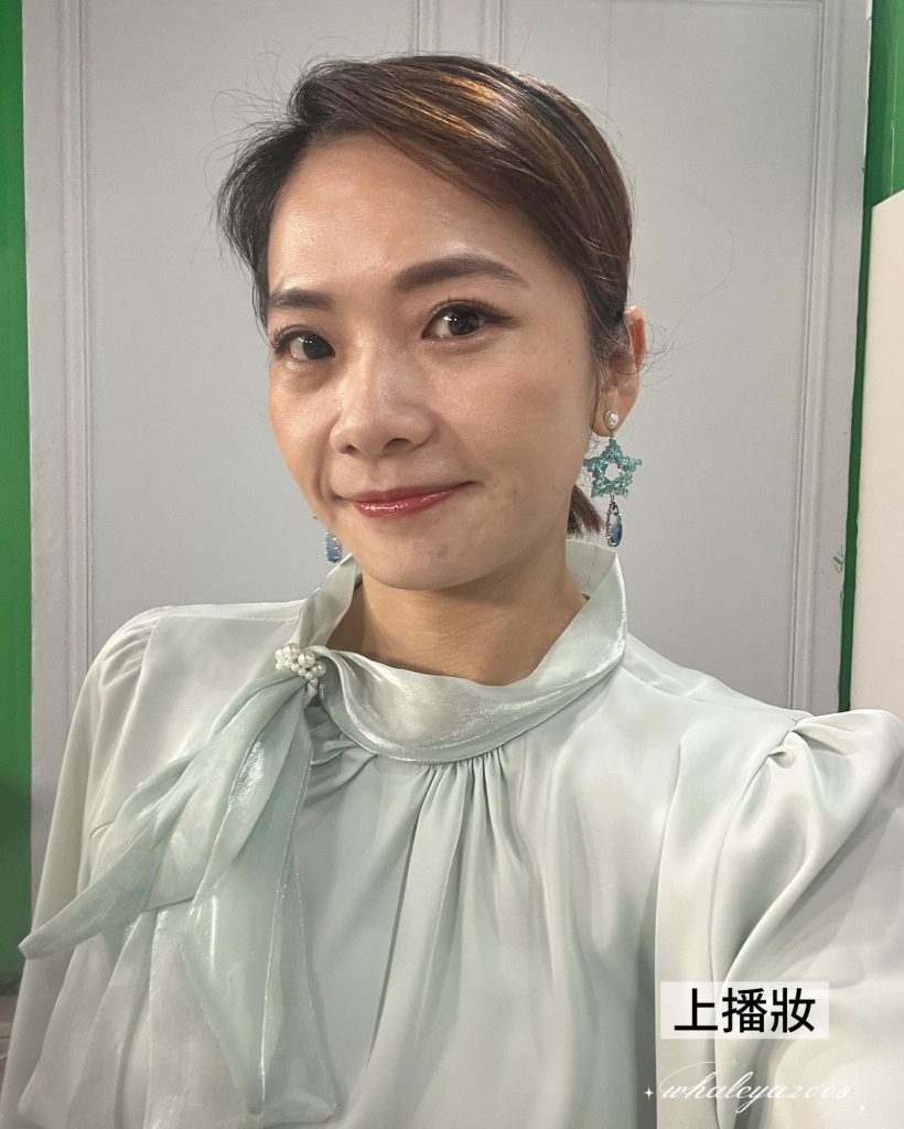 40歲後肌膚真的可以變好嗎?我的蜂巢皮秒雷射斑點改善完整紀錄分享|彥靚診所 4 pico laser melasma