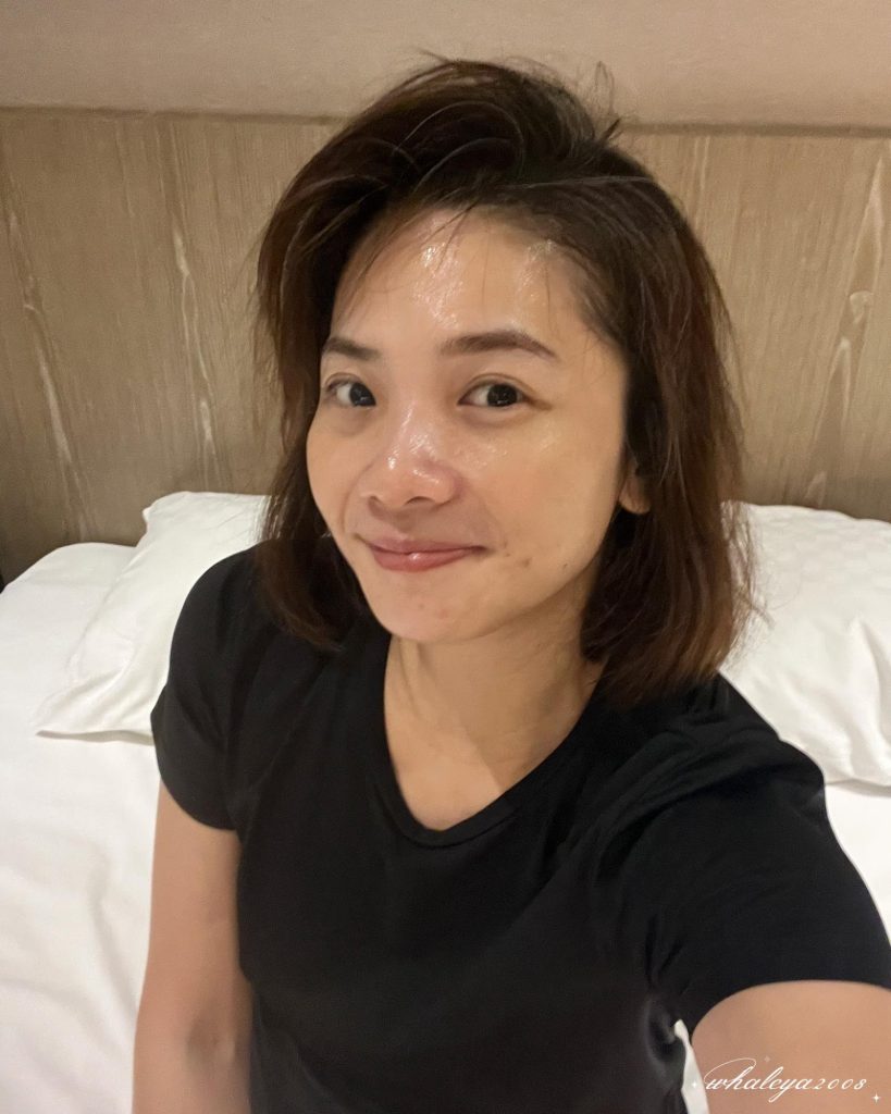 40歲後肌膚真的可以變好嗎?我的蜂巢皮秒雷射斑點改善完整紀錄分享|彥靚診所 6 pico laser pigmentation