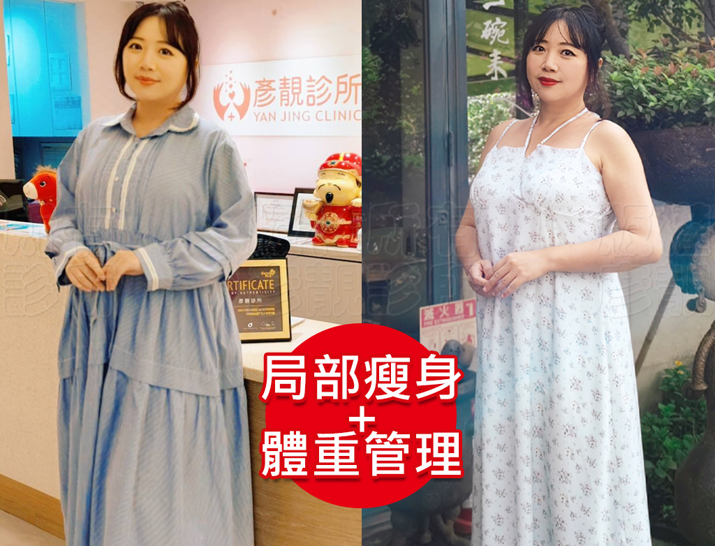 減重門診推薦|彥靚診所減重12公斤實錄:飲食控制、健身、旅行與外食經驗分享 44 postpartum weight loss plan