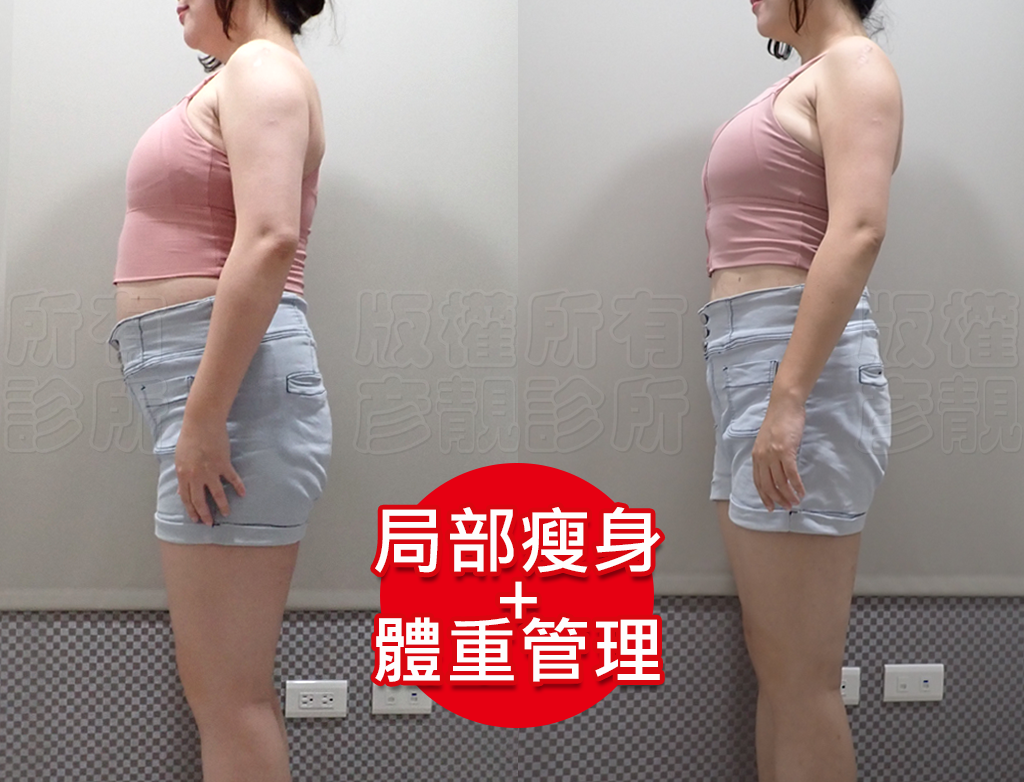 減重門診推薦|彥靚診所減重12公斤實錄:飲食控制、健身、旅行與外食經驗分享 42 slimming diary recommendation