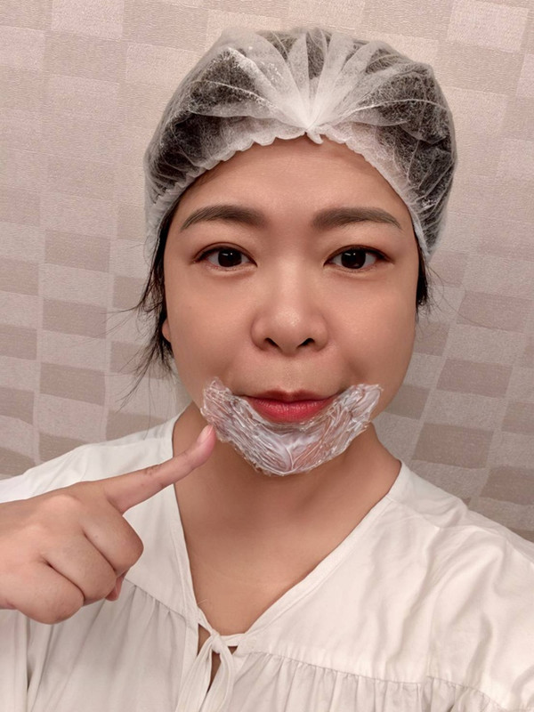【台北醫美評價】台北彥靚診所|松江南京站:4D無痕筋膜提升 打造精緻V線!擺脫木偶紋雕塑輪廓線真實心得 10 taoyuan facial contouring