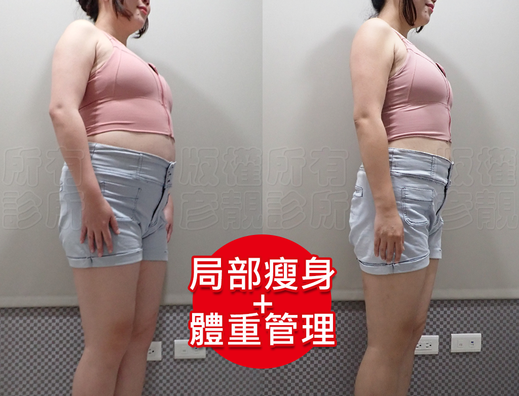 減重門診推薦|彥靚診所減重12公斤實錄:飲食控制、健身、旅行與外食經驗分享 39 thread embedding experience sharing