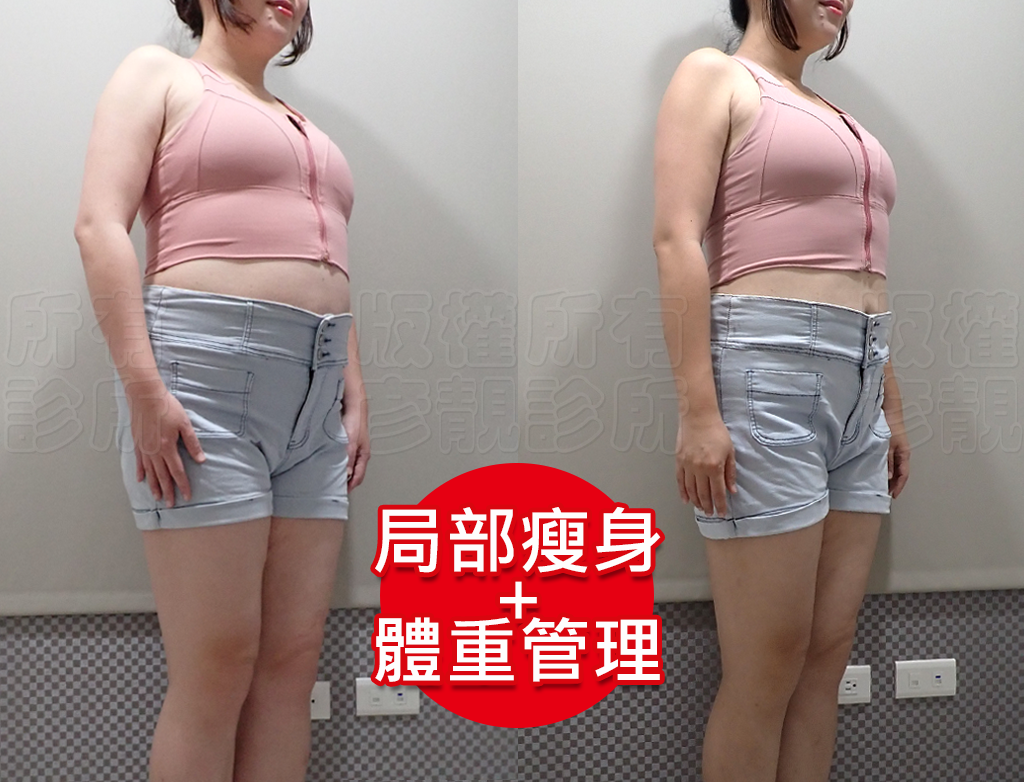 減重門診推薦|彥靚診所減重12公斤實錄:飲食控制、健身、旅行與外食經驗分享 38 yan jing clinic taoyuan