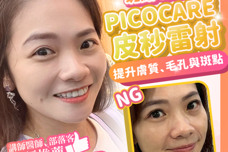 Picocare 皮秒雷射斑點改善日記資訊圖，左側為女性微笑自拍，右下近照標示原有斑點與膚色不均，版面文字聚焦提升膚質、毛孔與斑點，作為半年療程心得分享的主視覺