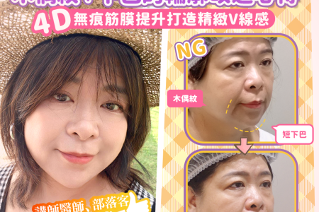 yanjing v line treatment