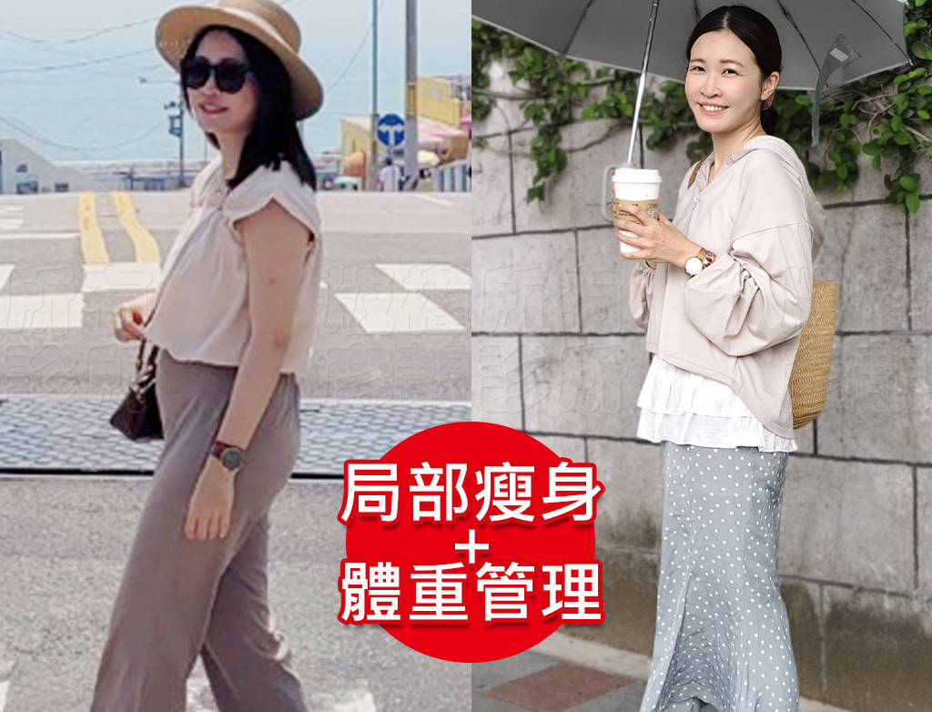 小腹剋星來了! 我的體態管理日記 彥靚診所 - 客製化的健康減重,免挨餓幫我成功瘦回S號!!! 43 thread embedding weight loss