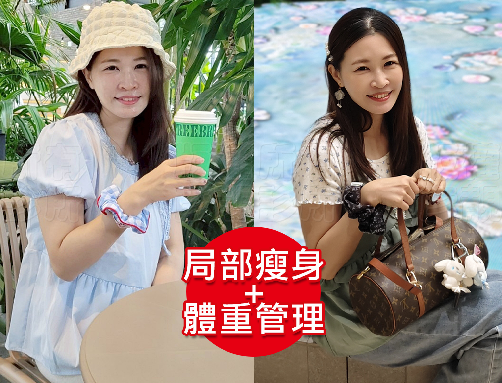小腹剋星來了! 我的體態管理日記 彥靚診所 - 客製化的健康減重,免挨餓幫我成功瘦回S號!!! 45 yanjing weight loss clinic