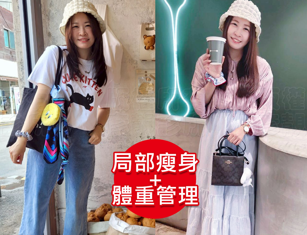 小腹剋星來了! 我的體態管理日記 彥靚診所 - 客製化的健康減重,免挨餓幫我成功瘦回S號!!! 46 yanjing weight loss taoyuan
